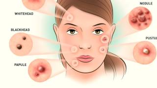 How to The many surprising uses of Listerine mouthwash