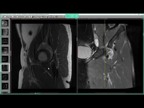 Video: Radiolog - Specific, Tipuri, Concluzie