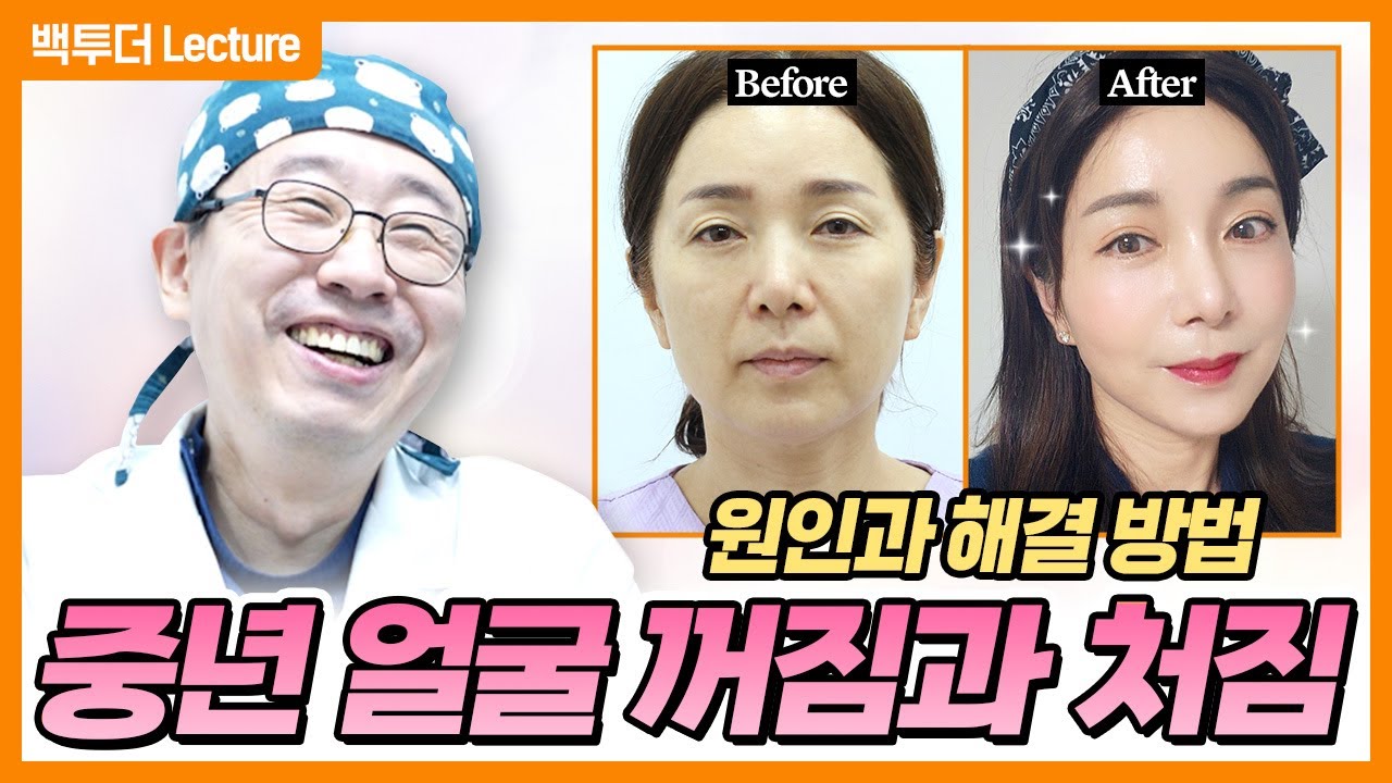 50대 중년성형 성공 비결! 지방이식 하나로 해결되는 이유