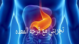 #تجربتي مع علاج قرح والتهابات المعدة #والاثني عشر واجابات علي اسئله الجروب