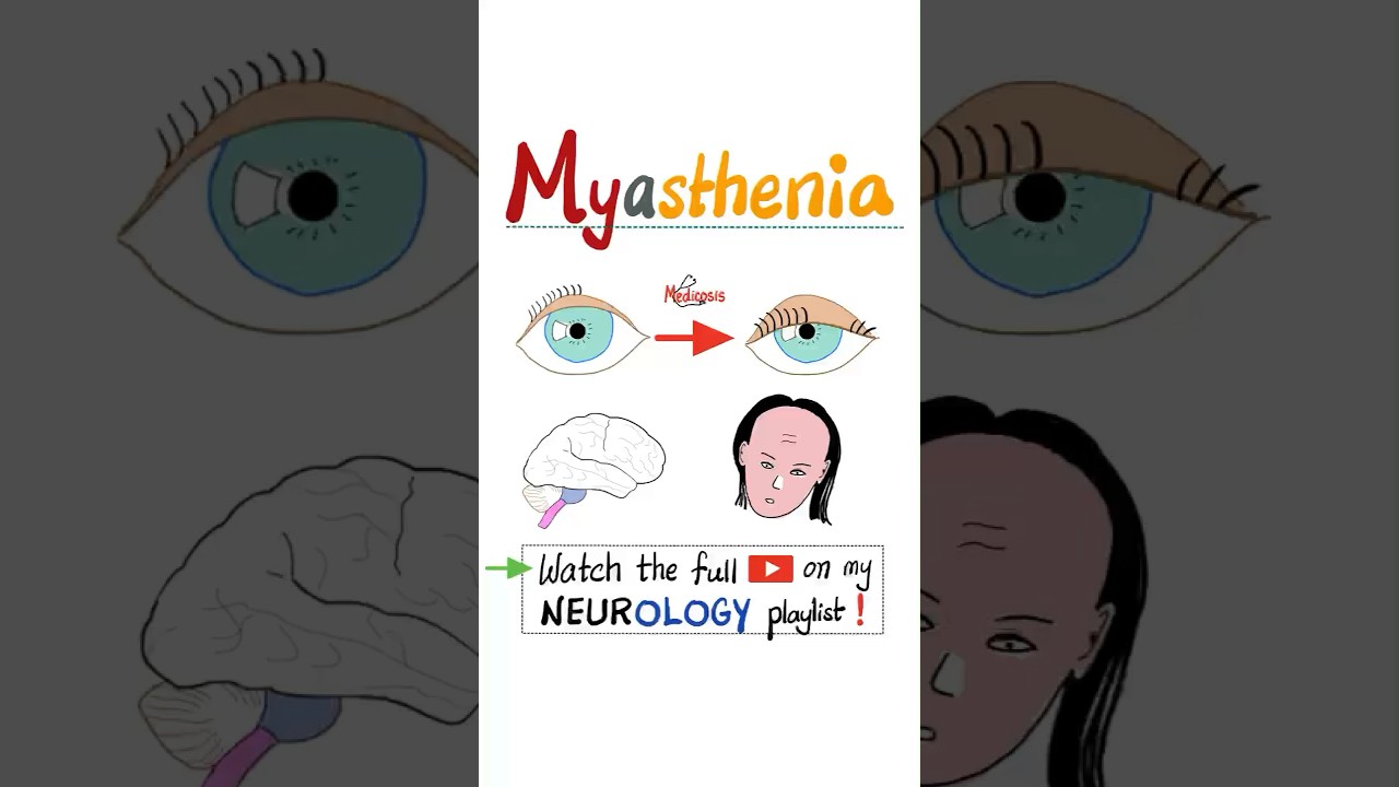 Myasthenia Gravis (MG) - Muscle Weakness, Fatigue…#science #anatomy #pathology #health #nurse #mbbs