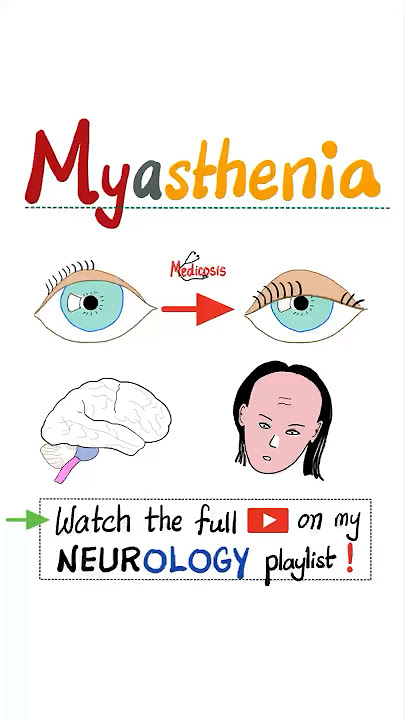 Myasthenia Gravis (MG) - Muscle Weakness, Fatigue…#science #anatomy #pathology #health #nurse #mbbs