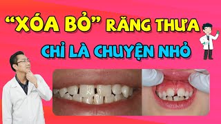 Top 8 cách làm răng hết thưa đặc sắc nhất năm 2022