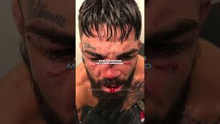 Mike Perry Talks Nose Injury vs. Luque