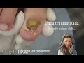 Chorei quando vi essa unha #satisfying #nails