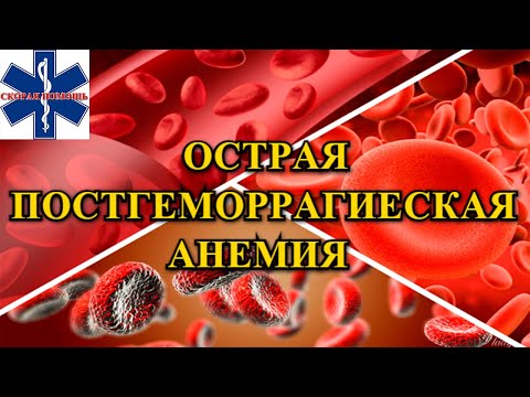 Видео: Что вызывает острую постгеморрагическую анемию?