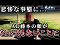【緊急事態】イベント出演前なのにAD藤本の顔がヤバい事になってしまいました。