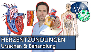 Kann eine Herzmuskelentzündung von alleine heilen?