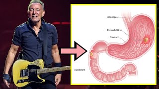 Bruce Springsteen’s illness (doctor explains)