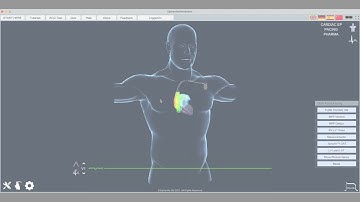 Epicardio Simulation™ Multi Point Pacing