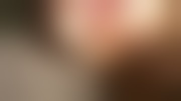 Physics Forceps Extraction of Upper Right Molar from GoldenDent, Atraumatic Extraction