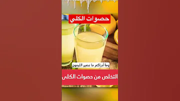 حصوات الكلى فى دقيقة دكريم على فكر تانى Shorts 