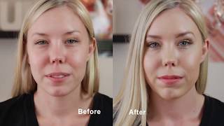 Zuii Organic Before & After - Taylor