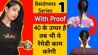 How to Prevent and Treat Baldness | Treatments for BALDNESS | Hair Loss Treatment for Men and Women