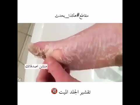 تقشير الجلد الميت من رجل Youtube
