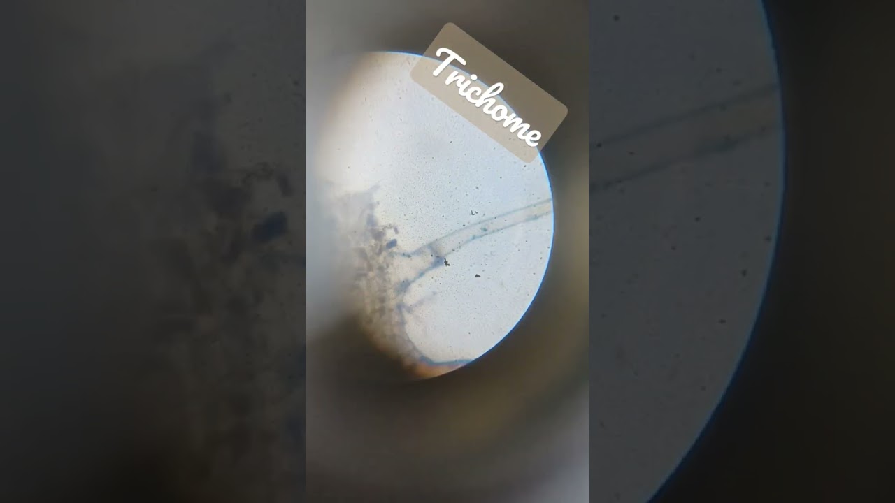 so this is self prepared  slide of Trichome......in microscope 🔬 🤔🙏😎🤩