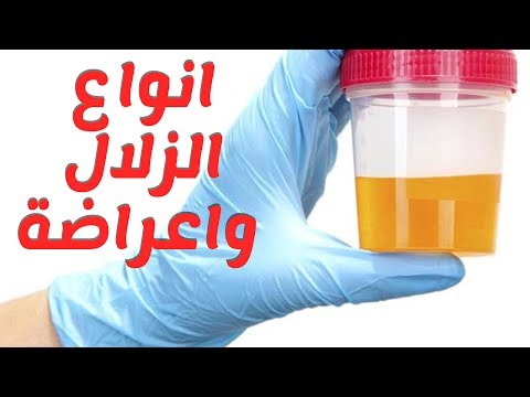 ماهي انواع مرض زلال البول واعراضه وطرق علاجه