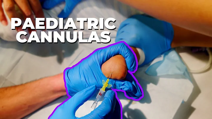 Get your paediatric cannula in first time - IV cannulation top tips