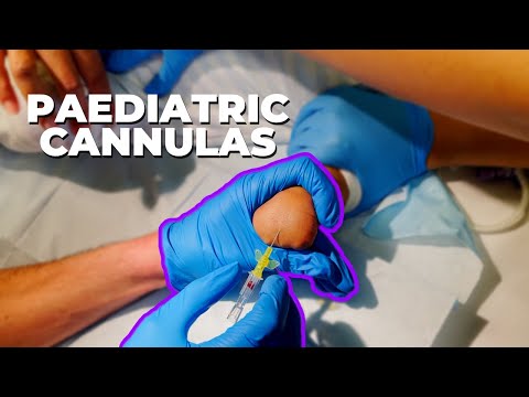 Get your paediatric cannula in first time - IV cannulation top tips