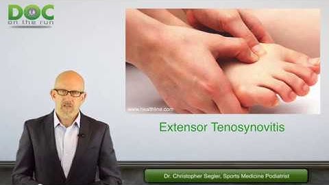 When Can I Run With Extensor Tenosynovitis?