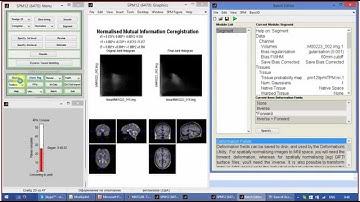 SPM12 (Kyiv 2015): part 4 - coregistration 2/2, segmentation 1/2