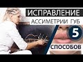 5 способов ИСПРАВЛЕНИЯ ассиметрии губ