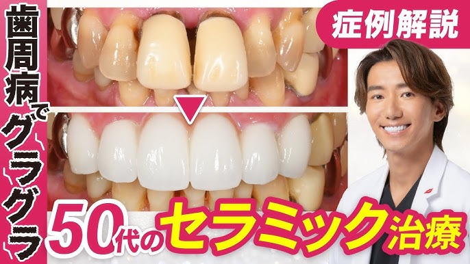 歯科治療のビフォーアフター画像活用術