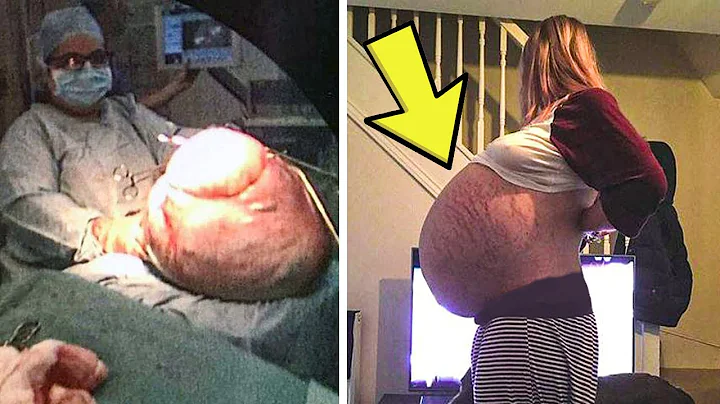 Woman's Stomach Just Keeps Getting Bigger Then She Realizes Shes Not Pregnant! - DayDayNews