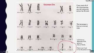 2020 Analyzing Karyotypes Video Lesson