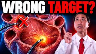 Why Some AFib Ablations Fail—Even With the Latest Technology
