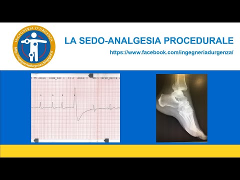 La sedoanalgesia procedurale in urgenza.