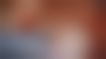 The 13th LION Global Broadcast 2018 Advanced Bionics Cochlear implantation Alex Huber