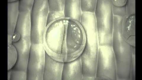 Eyespot Disease Preview Clip