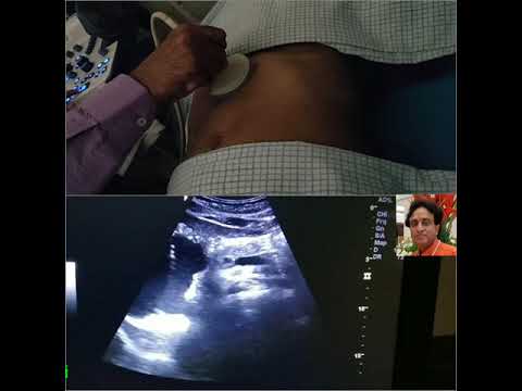 Pancreas How to look, Ultrasound, Tips Tricks Pitfalls, Portal Vein SMA, SMV, Splenic Vein Aorta,IVC