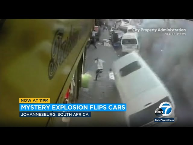 Mri Scanner Explodes Mri Explosion South Africa