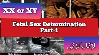 XX or XY Part-1 🤔💯❤️ | Fetal Gender Confirmation #ultrasound #medical #trending #gender #pregnancy Resimi