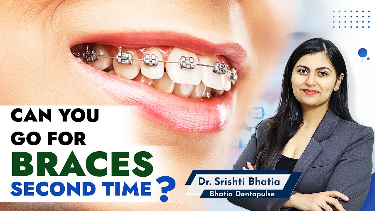 Can you Get BRACES a SECOND Time? Dr. Srishti Bhatia #braces #bracessmile #smilemakeover