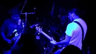 Audiotrauma - Parálisis facial