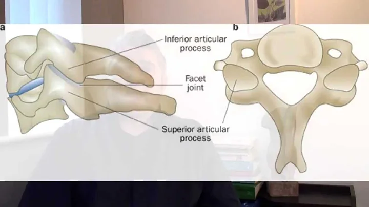 Facet Joint Pain. What causes it? What can you do about It?