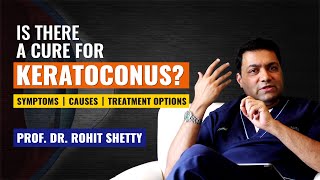 Is there a cure for KERATOCONUS? | Keratoconus Treatment | Symptoms | Causes | Prof. Rohit Shetty