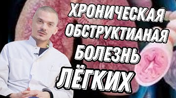 Как перестать кашлять? как отличить горловой кашель от легочного? #медицина #поликлиника