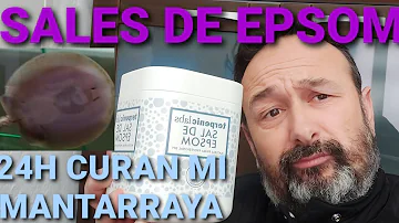 ¿Cómo se utiliza la sal de Epsom en un acuario?