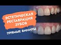 Эстетическая реставрация зубов: прямые виниры!