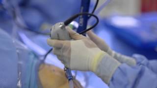 Knee Arthroscopy with Orthopedic Surgeon Dr. Christopher Wong