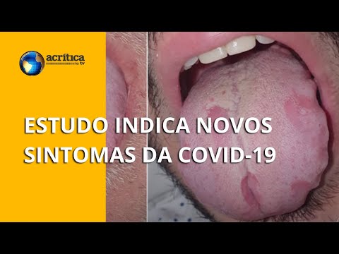 Vídeo: Placa na língua com coronavírus