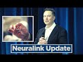 Neuralink Update (2020) - Highlights in 7 minutes