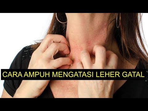 Ini Dia Penyebab dan Cara Ampuh Mengatasi Leher Gatal