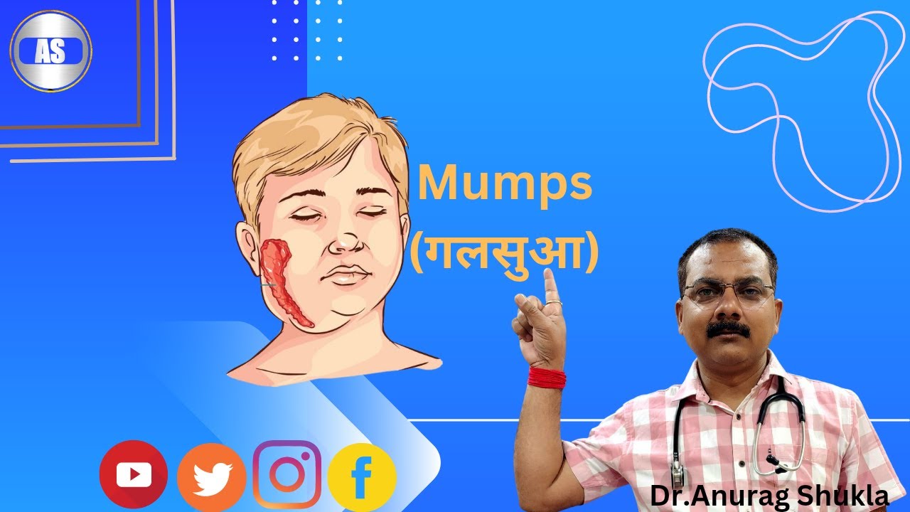 Mumps virus namemumps in hindiviral feverviral fever symptoms YouTube