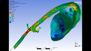 Simulation of the Insertion of a Catheter Wire in Thoracic Aorta and Heart - ANSYS Explicit Dynamics