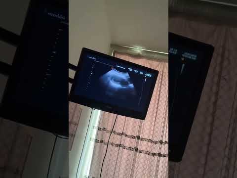 شو بتقولو صبي او بنت بعد ما عرفت انا